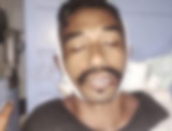 Belum Sehari, Pengedar Narkoba di Flotim Meninggal